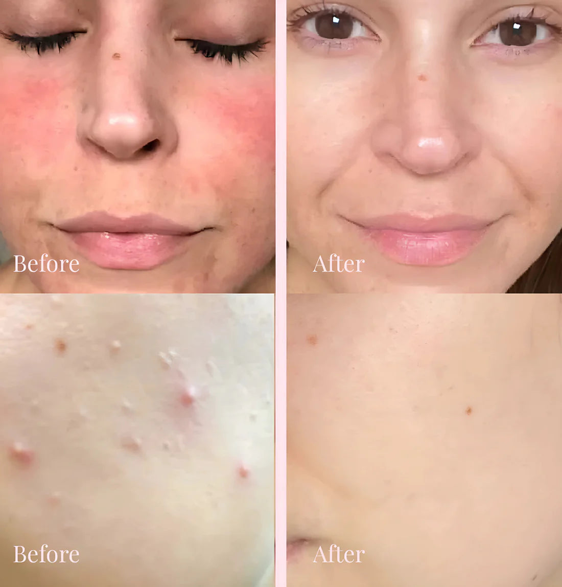 Solenne Reviving PDRN Collagen Cream