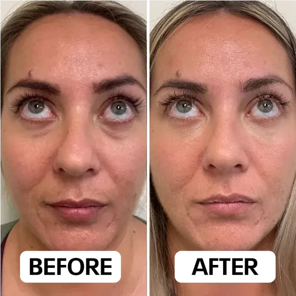 Solenne HydroGlow-pleisters