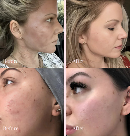 Solenne Reviving PDRN Collagen Cream